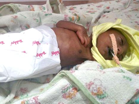 2 weeks old baby girl with strange looks