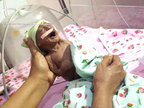 2 weeks old baby girl with strange looks