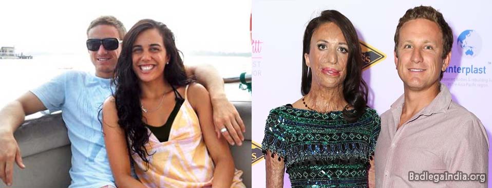 Turia Pitt and Michael Hoskin